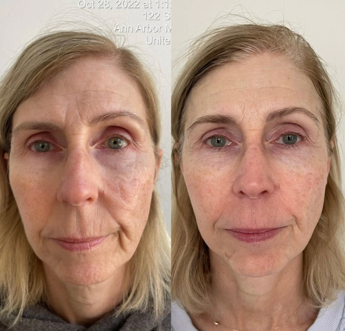 KrX Youthplex Face Lift Serum