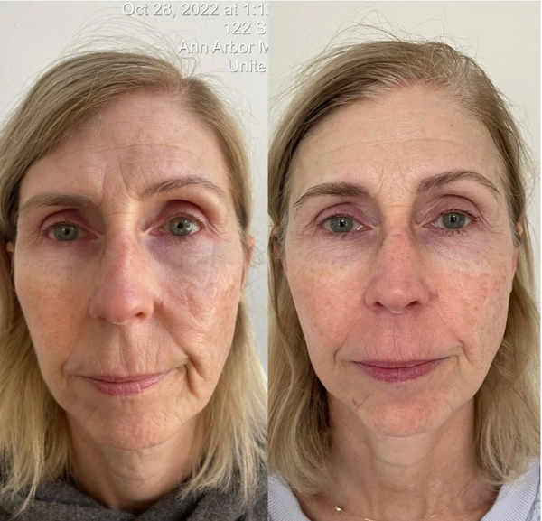 KrX Youthplex Face Lift Cream